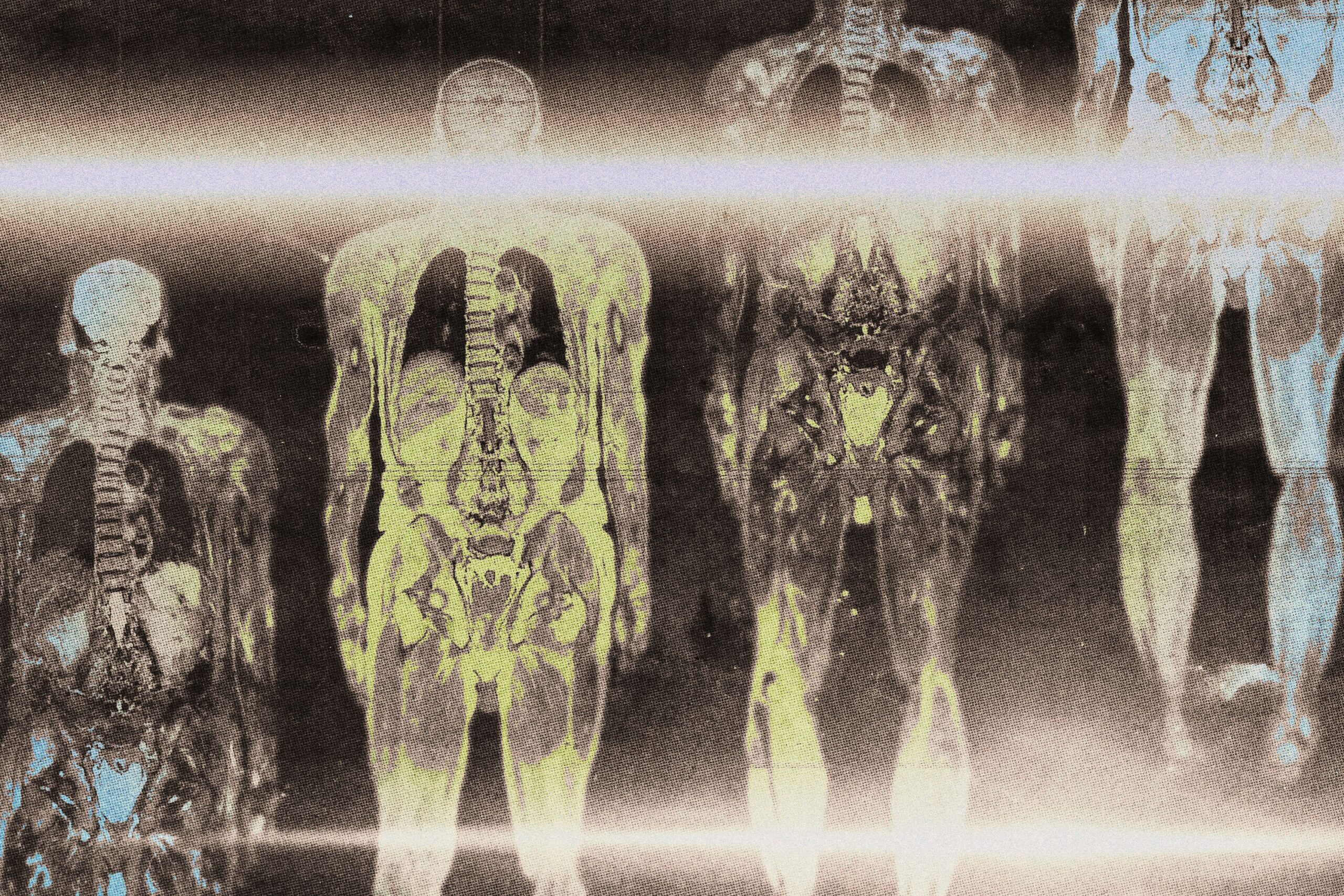 Day 8 - Full Body Scan With Neutrality