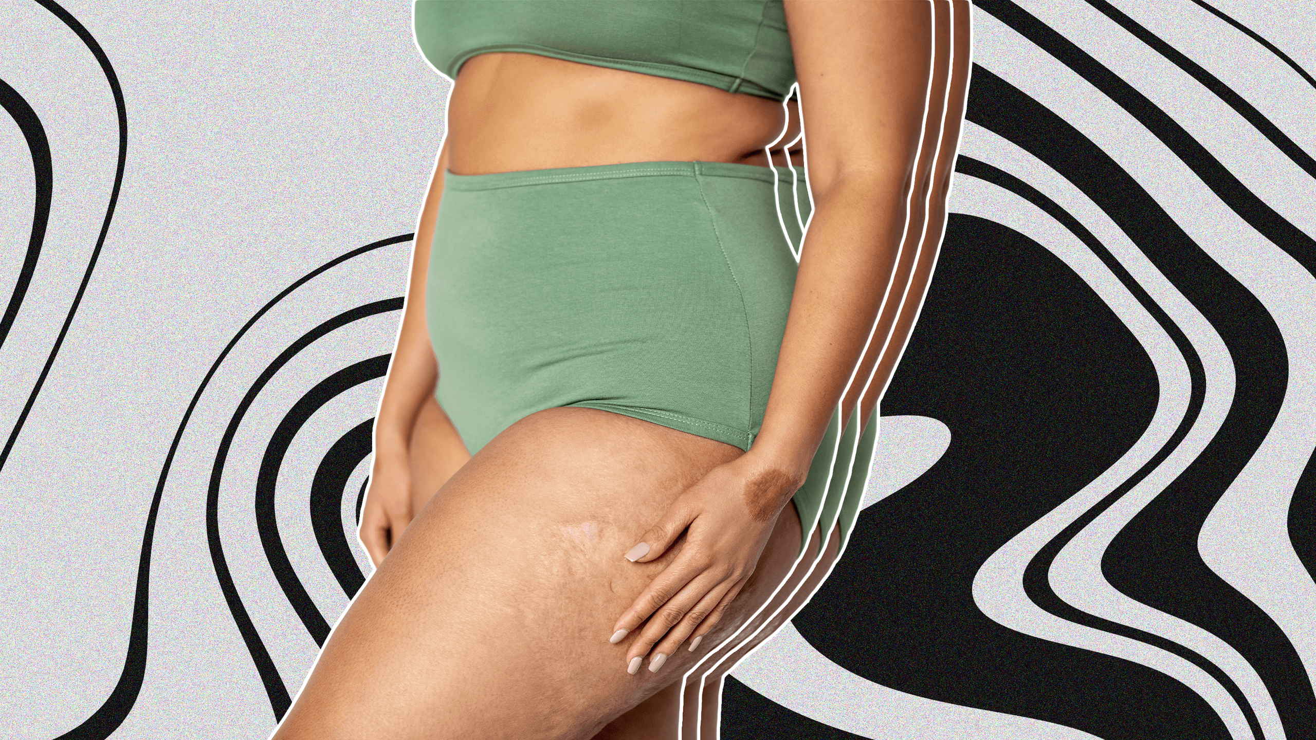 How to Treat Chafing When It Happens