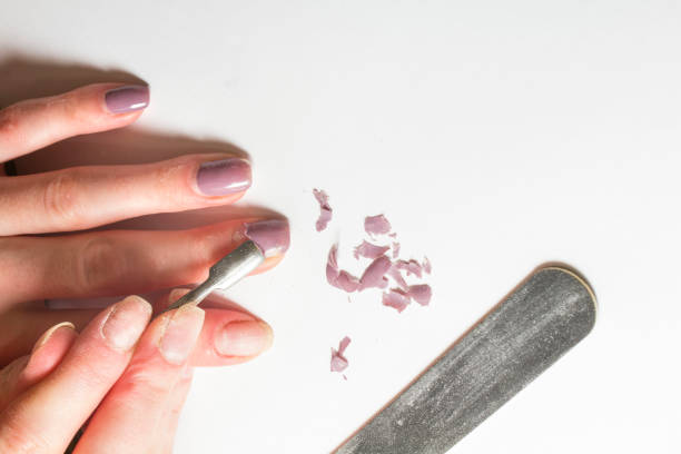 Removing Acrylics