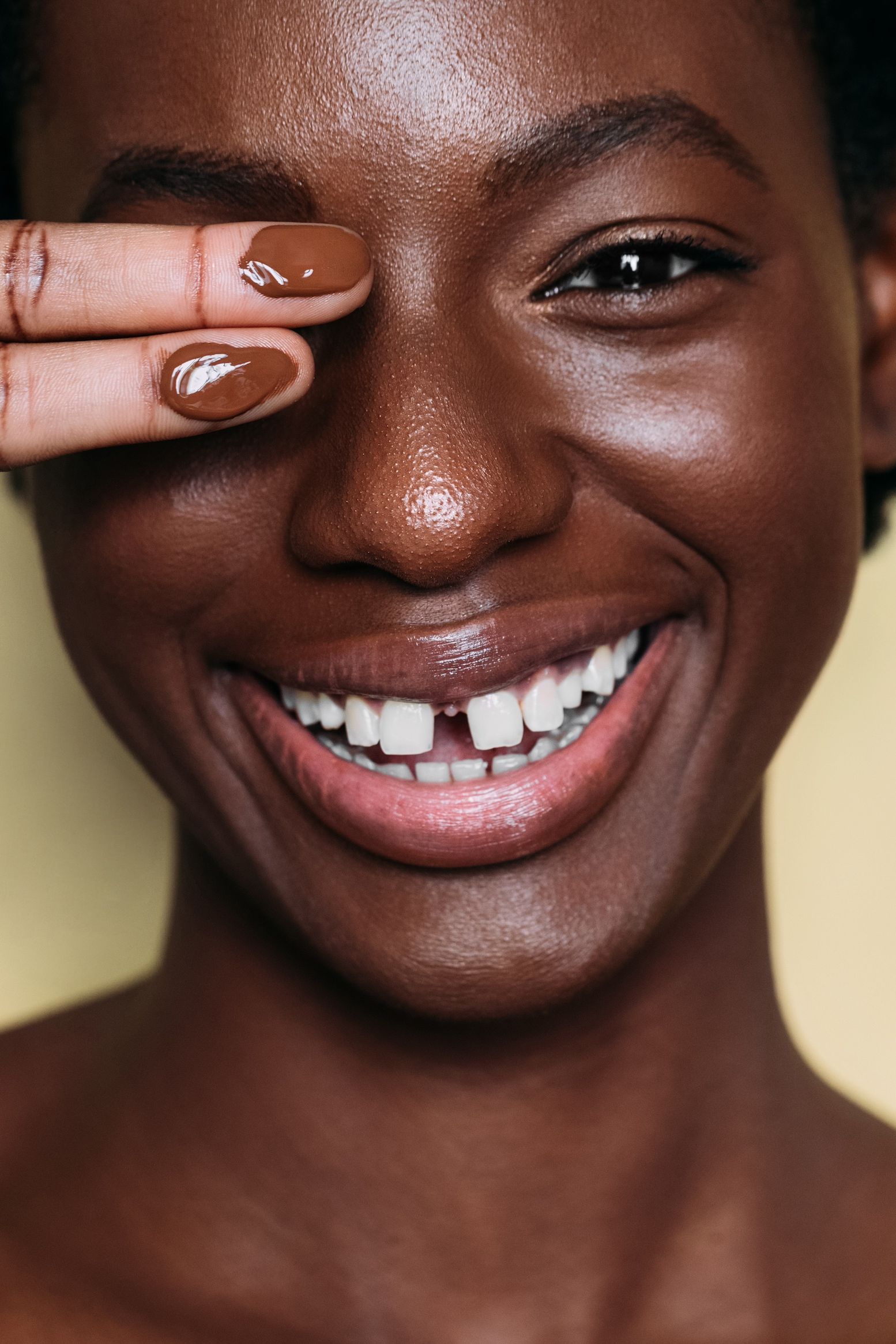 Why Dark Circles on Dark Skin Need a Different Approach