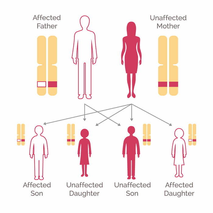 Family History and the Role of BRCA Genes