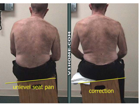 The Lumbar Problem and the Thirty-Five-Dollar Fix