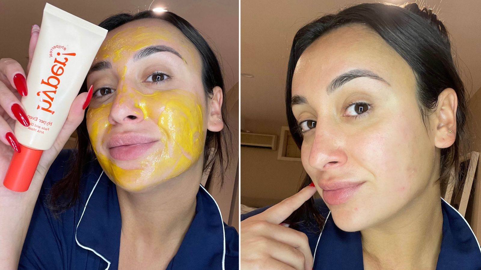 Hyper Skin Review for Plus-Size Body Hyperpigmentation: 9 Months of Receipts
