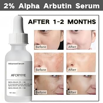 Hyper Skin compared to The Ordinary Alpha Arbutin and Topicals Faded dark spot products flat lay