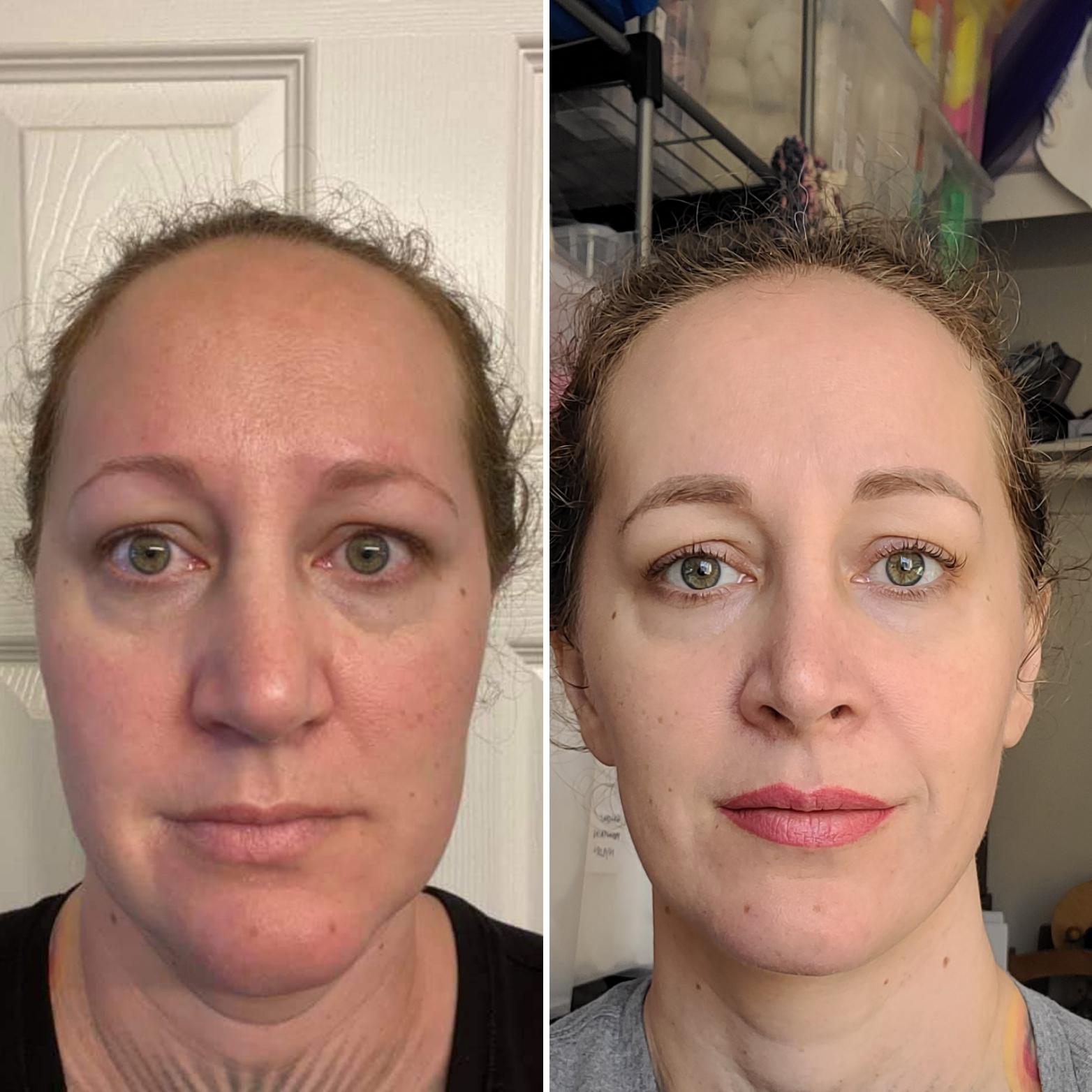 Before and after comparison showing improvement from affordable anti-aging routine